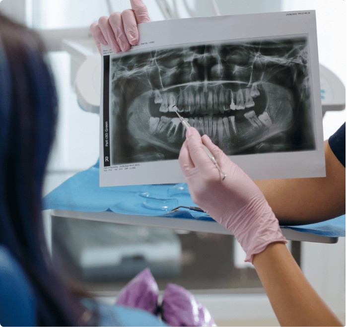 dental-x-ray dental x-ray