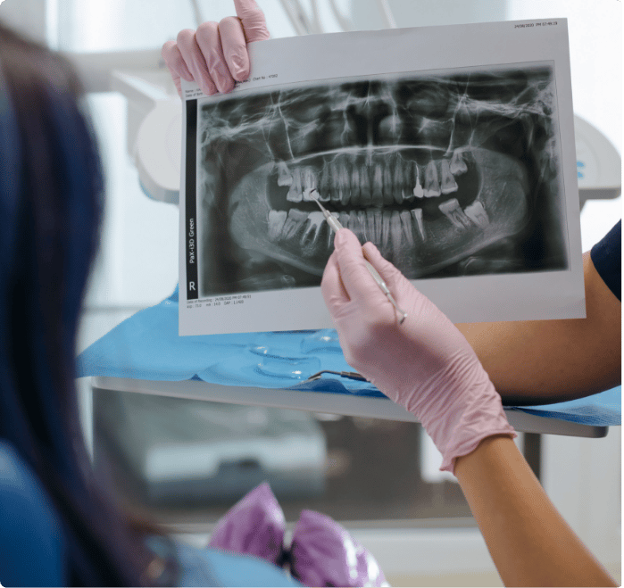 dental x-ray